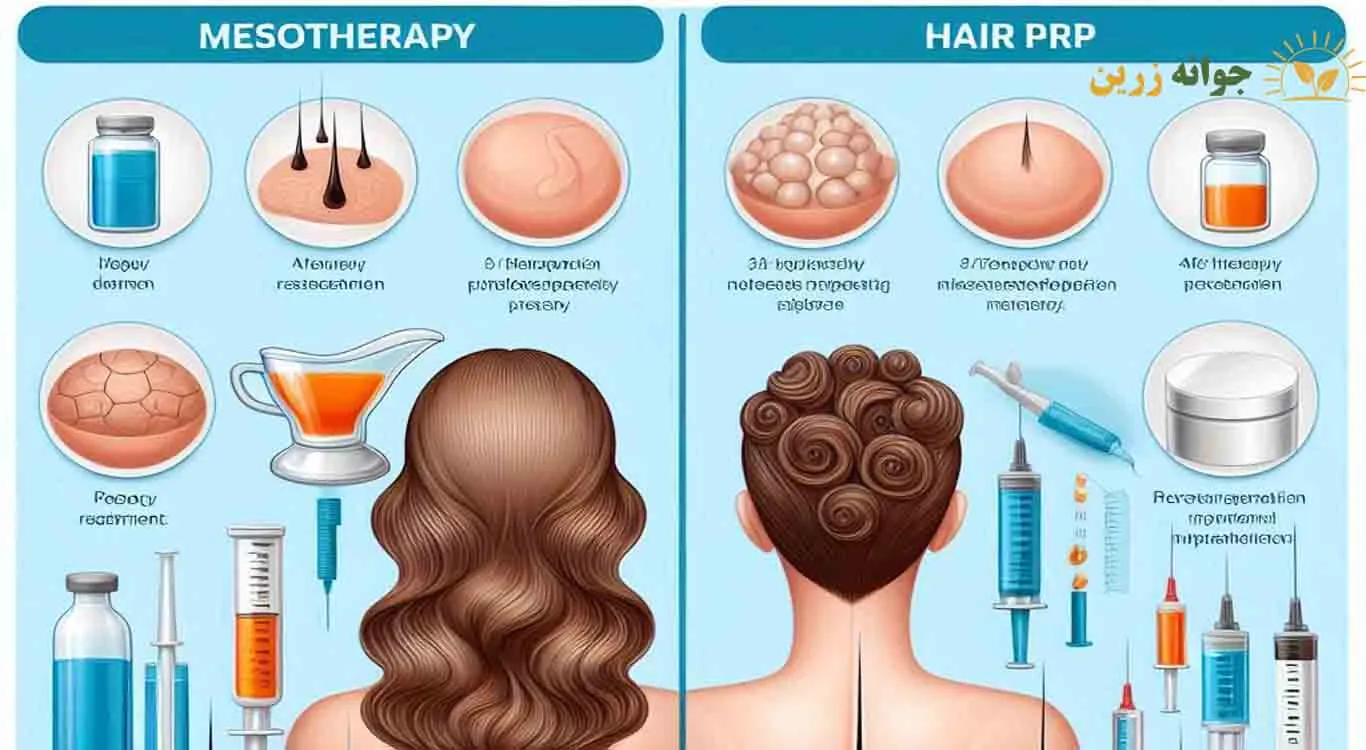 After-hair-transplant-PRP-or-mesotherapy