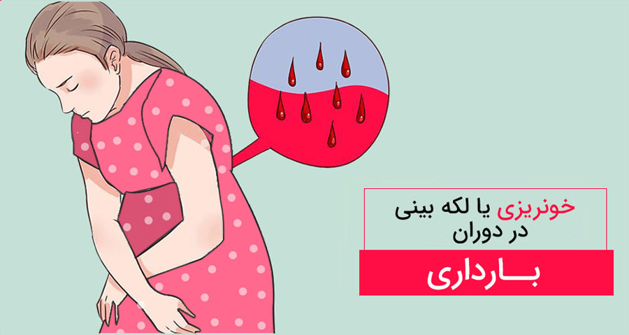 Bleeding-during-pregnancy Bleeding-during-pregnancy