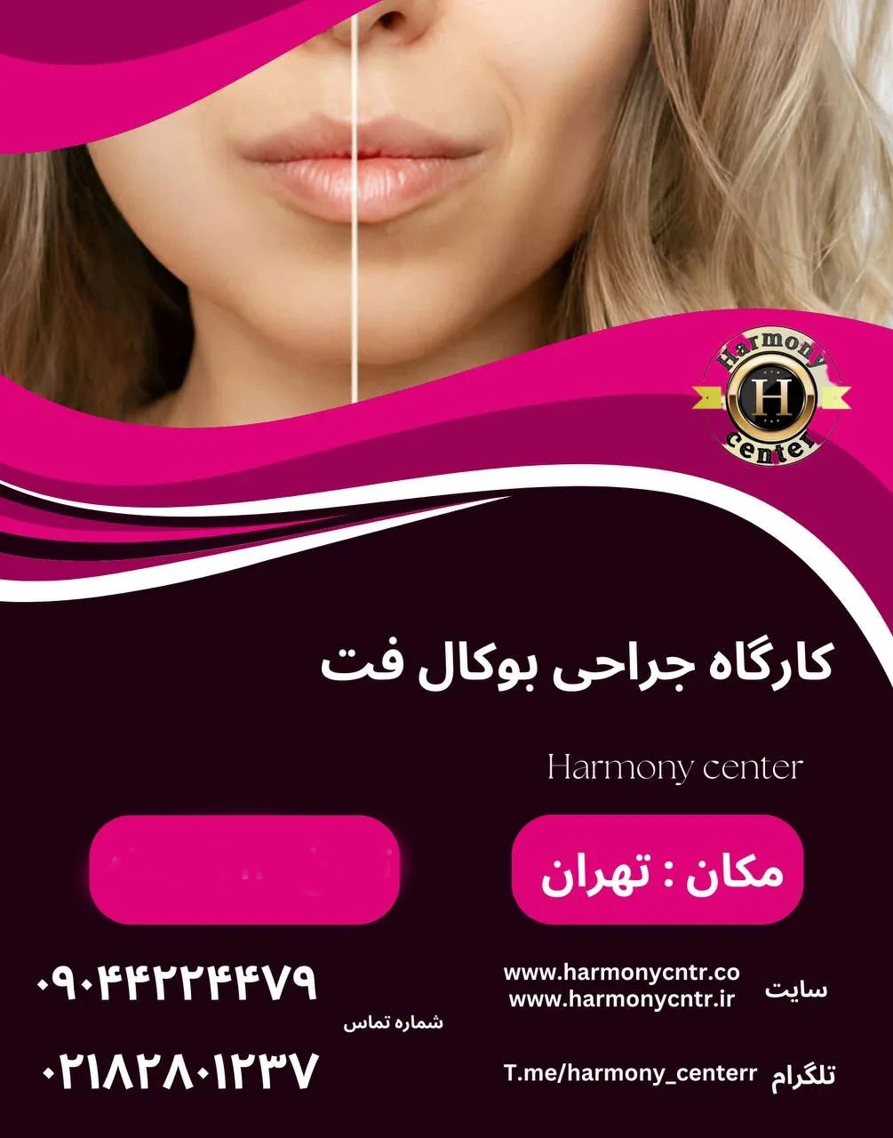 Buccal-fat-training-workshop