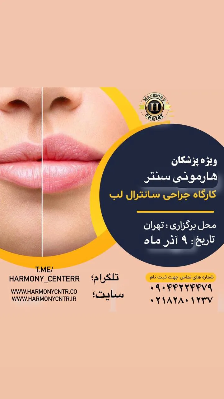Central-lip-lift-workshop Central-lip-lift-workshop
