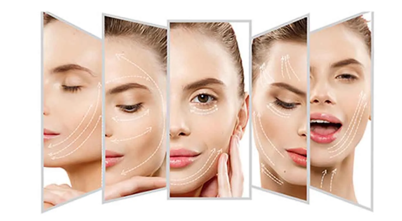 Fast-and-painless-thread-facelift-for-wrinkles