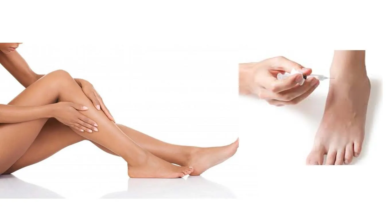 Filler-injection-to-leg-and-ankle Filler-injection-to-leg-and-ankle