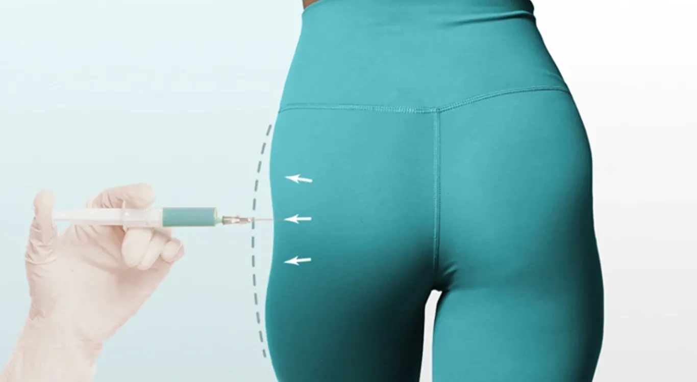 How-Long-Does-Body-Filler-Last