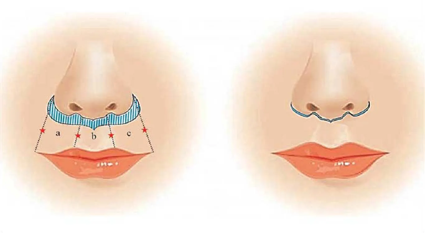 How-can-non-invasive-beauty-techniques-help-you-succeed