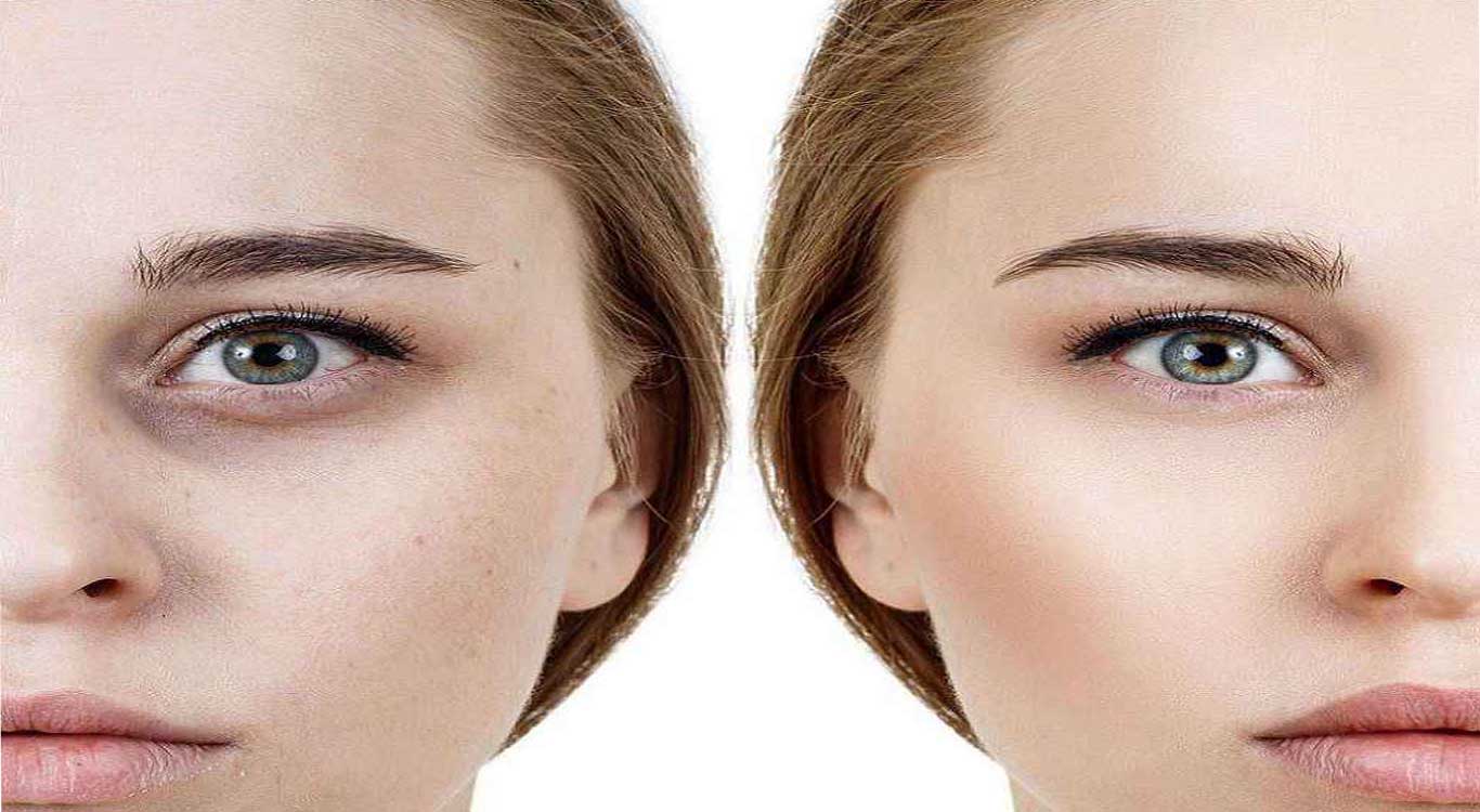 Mesotherapy-The-Secret-of-Successful-Beauty-Clinics