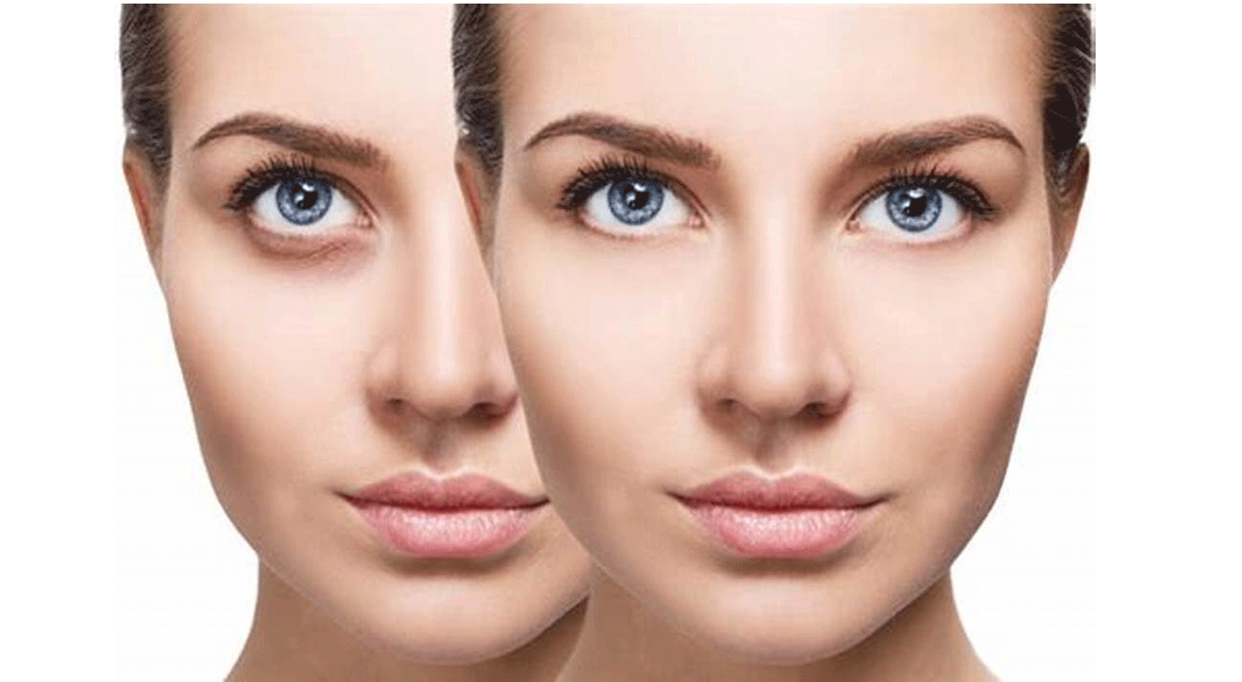 Mesotherapy-and-PRP-Skin-Rejuvenation-Methods