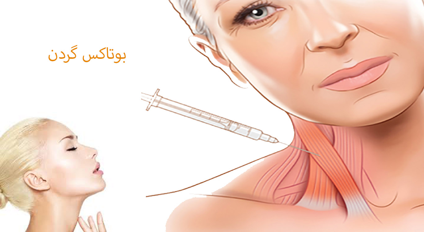 Neck-Botox-for-Smoother-Skin